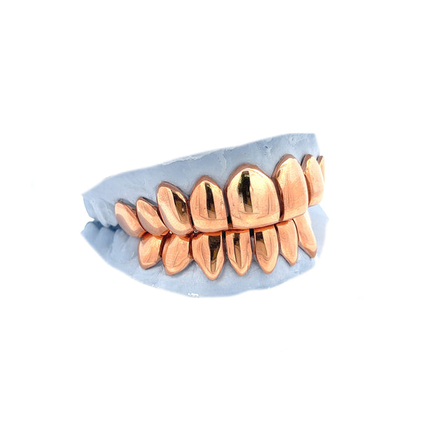 OG Gold Grillz