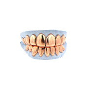 OG Gold Grillz