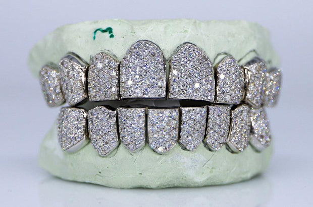 Vs Quality Diamond Grillz