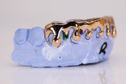 Drip Gold Grillz