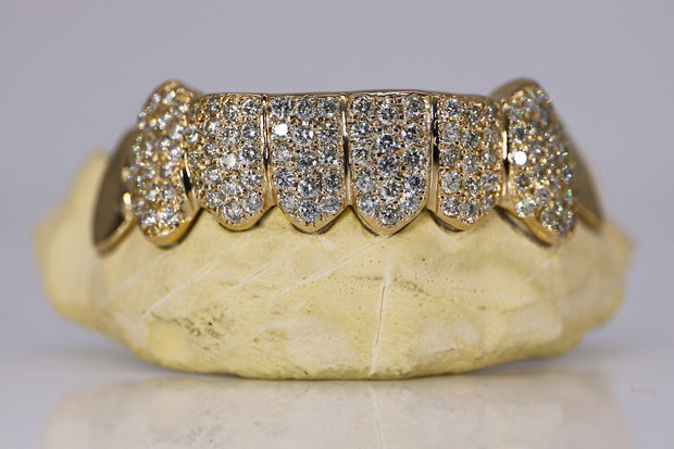 Capped Diamond Grillz SI Clarity