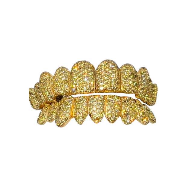 Custom Canary Hand Set Diamond Grillz (Zigzag setting)