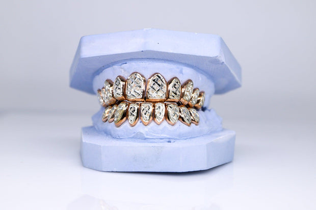 Two-Tone Diamond Dust Gold Grillz