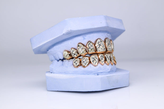 Two-Tone Diamond Dust Gold Grillz