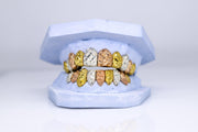 TRI-TONE GRILLZ WITH DIAMOND CUT DIAMOND DUST GOLD GRILLZ