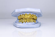 Gold Nugget Grillz