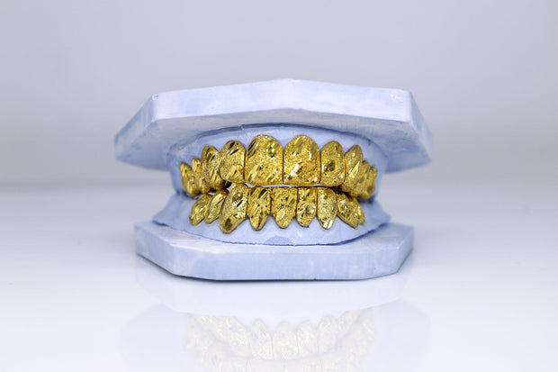 Gold Nugget Grillz