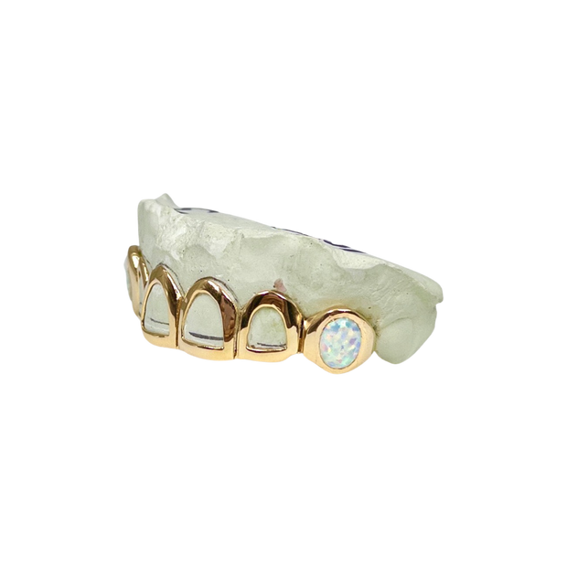 Custom Open Face Grillz with Opal Fangs