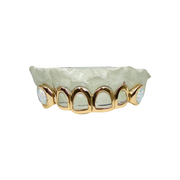 Custom Open Face Grillz with Opal Fangs