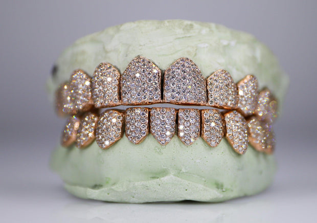 Vs Quality Diamond Grillz