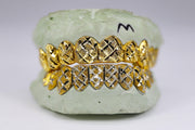 Diamond Cut Diamond Dust Two-Tone Gold Grillz