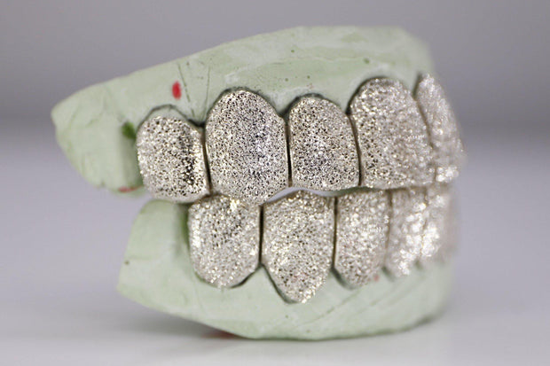 Diamond Dust Grillz