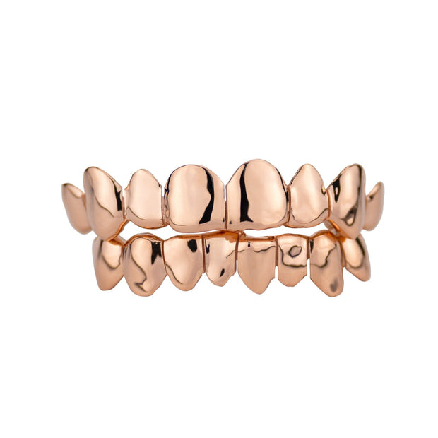 SPECIAL: Custom Solid Gold Grillz